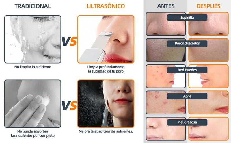 💗RadiantSonic - Paleta Ultrasónica Limpiador Facial💗