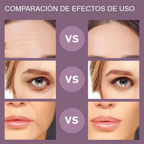 ✨MASAJEADOR FACIAL REJUVENECEDOR✨